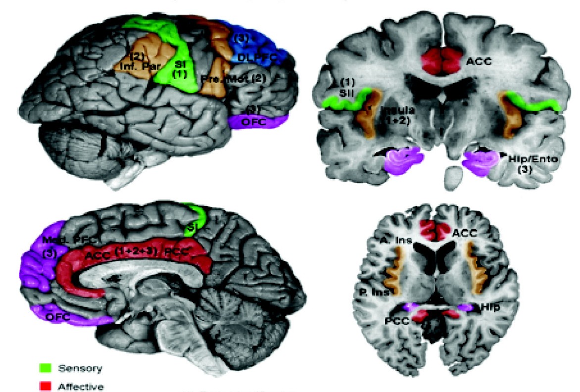 Schematic of fMRI of brain, a diagnostic tool used to analyze mutitasking